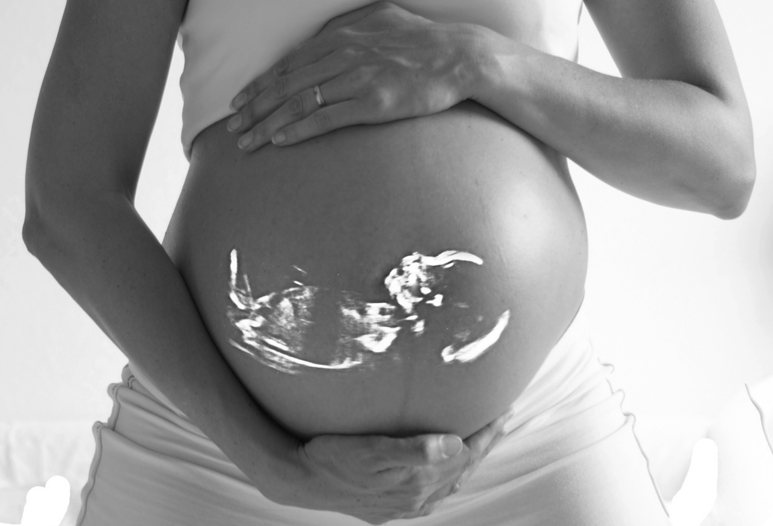 Aborto e perforazione uterina, nuovi casi. Ecco cosa rischiano le donne 1